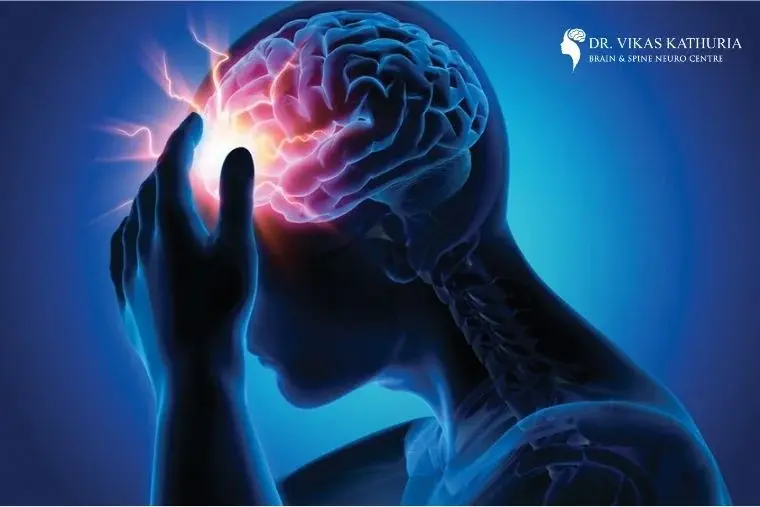 Brain Stroke Treatment Doctor in Gurgaon